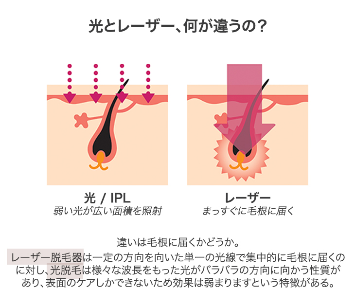 家庭用脱毛器おすすめ激選ベスト8！ツルスベ肌を１年中続ける方法が簡単に手に入る！