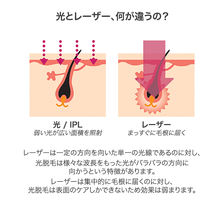 トリア脱毛器で効果がでない理由！痛みを緩和して照射レベルを上げる方法とは？